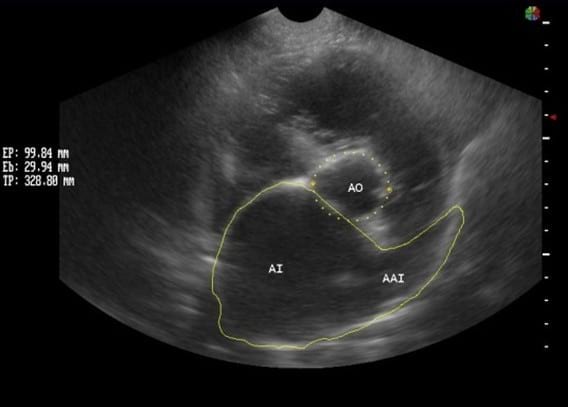 Caso Clínico: Cardiomiopatia Dilatada Canina Con Fibrilacion Atrial ...