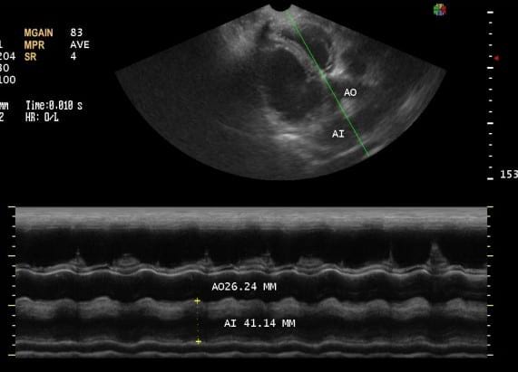 Caso Clínico: Cardiomiopatia Dilatada Canina Con Fibrilacion Atrial ...