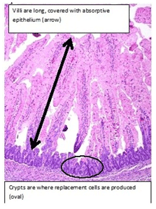 Looking for ways to get relief from PED - Engormix
