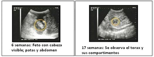 Ha acabado de un pequeño pene