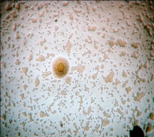 Programa Pulsátil de Antibióticos para Micoplasma