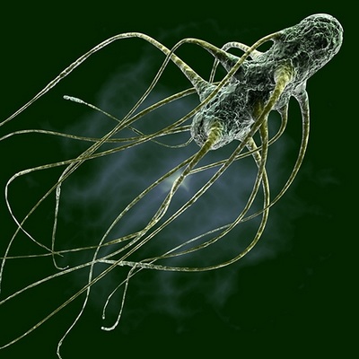 Factores de Riesgo de Salmonella Gallinarum