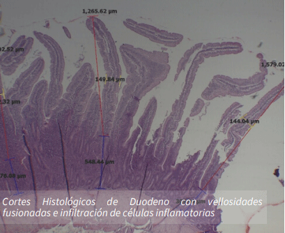 Histología de duodeno mostrando vellosidades intestinales.