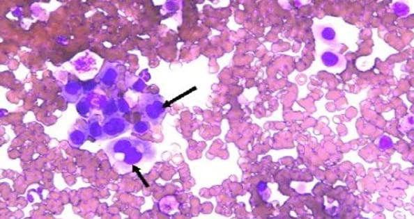 histopatología de la prostatitis supurativa canina