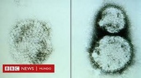 Hantavirus: Definición, Transmisión y Síntomas Clave