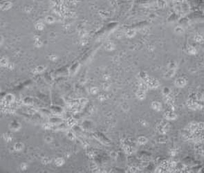 Citotoxicidad combinada AFB1/FB1 en intestino porcino