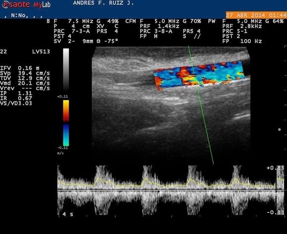Diagnóstico Reproductivo por Ultrasonido Doppler color. - Servicios Técnicos Andrés F. Ruiz J. - GENBIOGAN.
