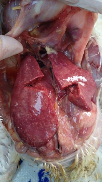 Big liver - Clinical issues